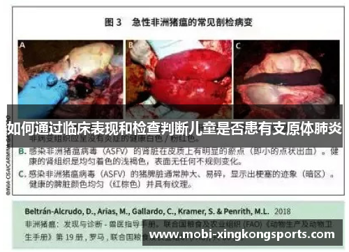 如何通过临床表现和检查判断儿童是否患有支原体肺炎